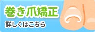 巻き爪矯正